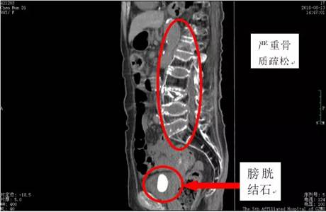 说明: C:\Users\gywy\AppData\Roaming\Tencent\Users\447919325\TIM\WinTemp\RichOle\6@9$FPJ~YD~`%EW[E7$LGXF.png