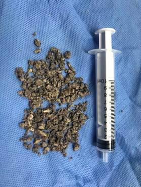 说明: C:\Users\gywy\AppData\Roaming\Tencent\Users\447919325\TIM\WinTemp\RichOle\)[031ZKVDNB7BMWC`X_STW5.png