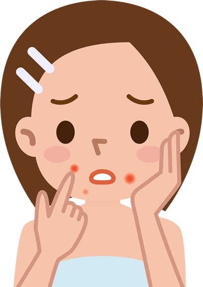 皮肤头号烦恼反反复复的青春痘怎么破